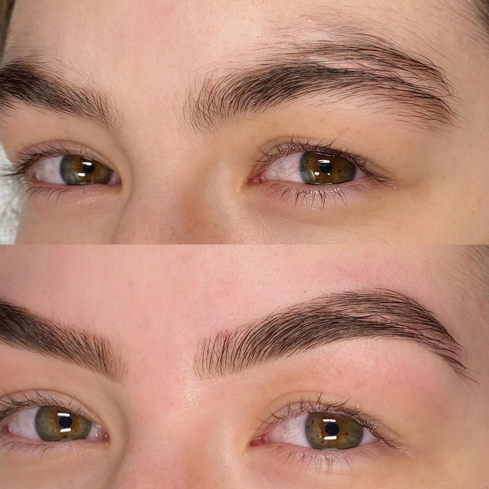 Augenbrauen vor und nach dem Browlifting im direkten Vergleich